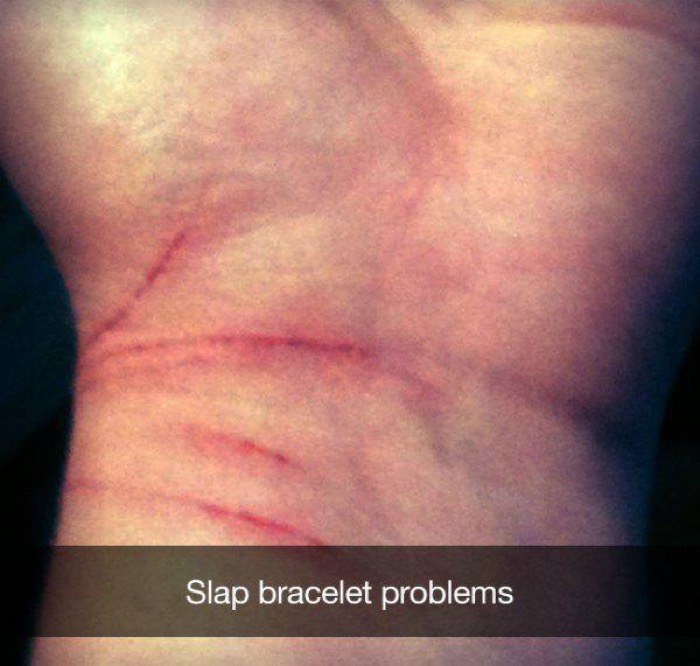 slap bracele