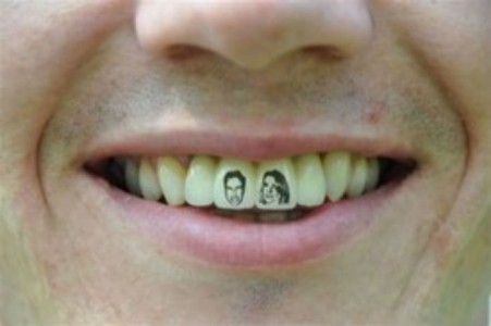 Ya no es en la piel, ahora los tatuajes se hacen ¡en los dientes!