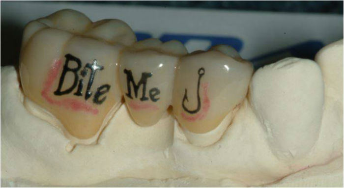 tooth-tattoo-bridge