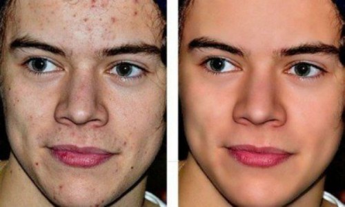 14 hombres famosos con y sin photoshop, ellos también esconden defectos