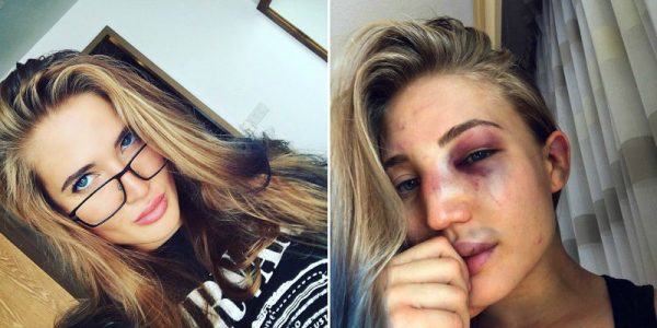 ¡Impactante! Selfie de una modelo rusa muestra lo brutal que son las artes marciales