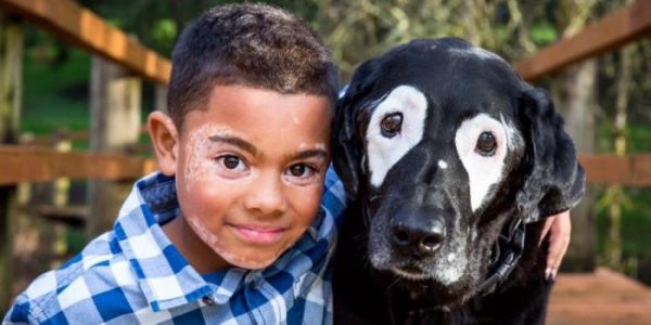 ¡Conmovedor! Niño con vitiligo sale de su depresión al conocer a un perro con su misma enfermedad