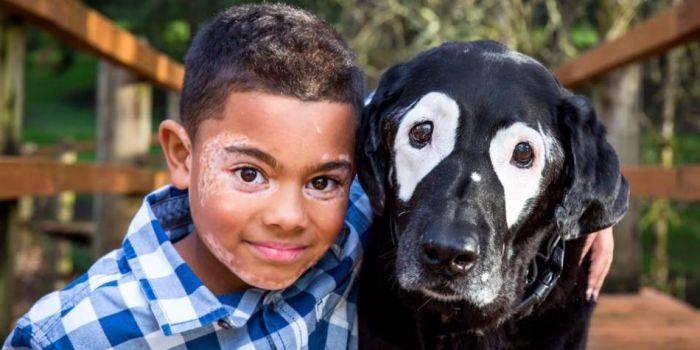 perro alegra a niño con vitiligo