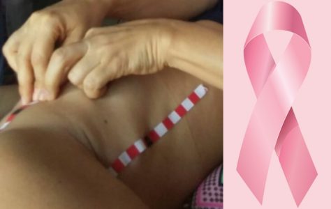 Manos que salvan vidas: Estas mujeres ciegas detectan el cáncer con sus manos