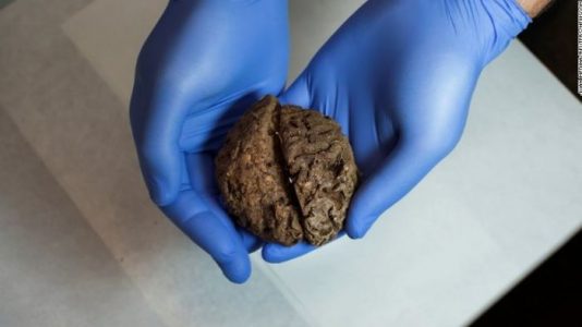 Docenas de cerebros intactos fueron descubiertos en una fosa común de 80 años