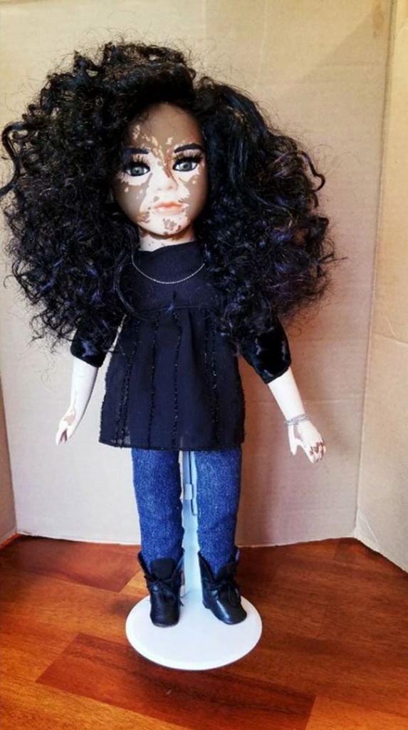 artista crea muñecas con vitiligo