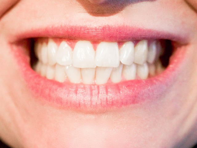 Este nuevo tratamiento dental podría curar las caries sin necesidad de empastes