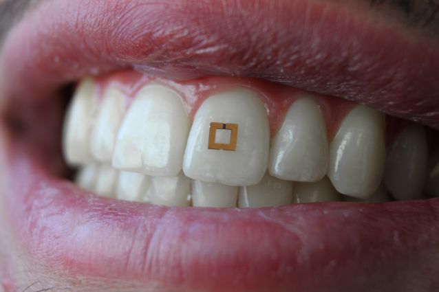 Este sensor unido a tu diente hace un seguimiento de lo que comes