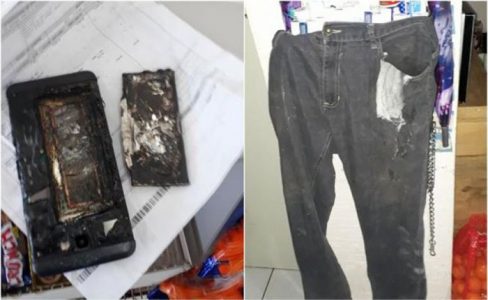 Un hombre en México sufre quemaduras graves al explotar su teléfono en su bolsillo