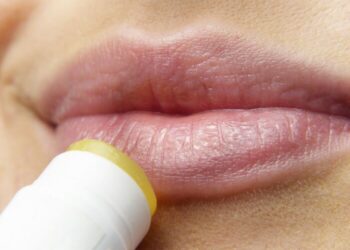 labios agrietados