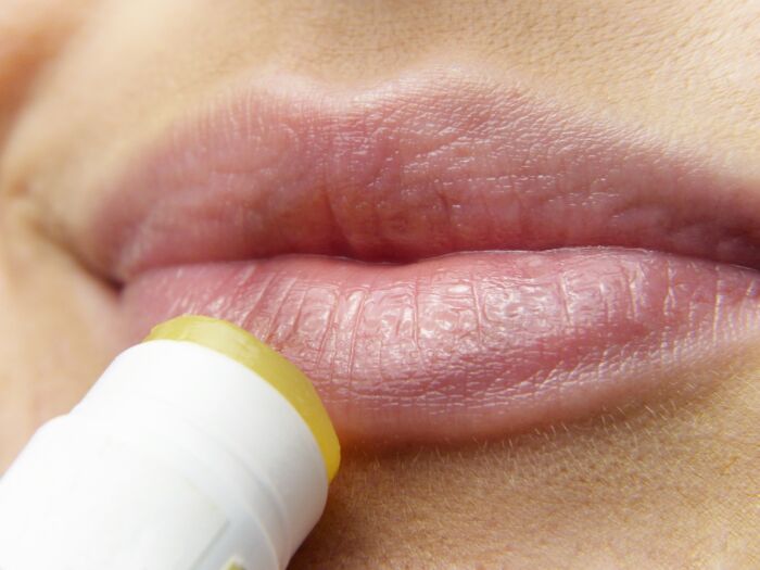 labios agrietados